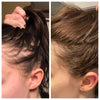 8-tygodniowa Kuracja Redukująca Wypadanie Włosów