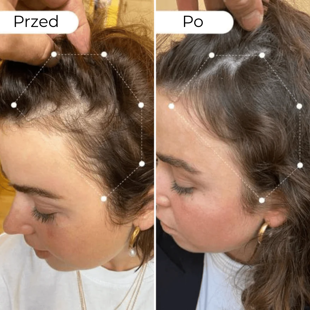 Serum Redukujące Wypadanie Włosów