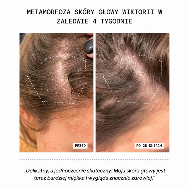 Peeling oczyszczający do skóry głowy