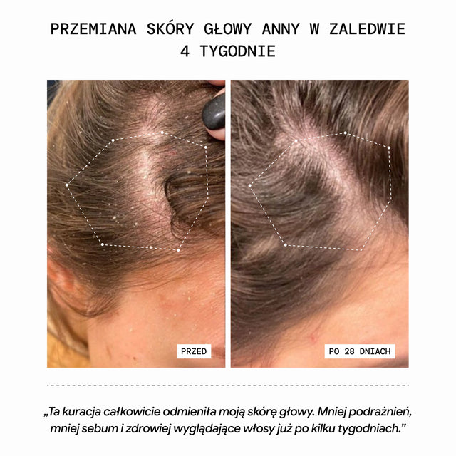 Pełna Kuracja Regenerująca Skórę Głowy