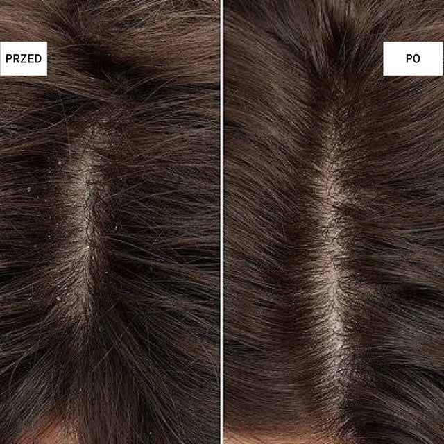 Peeling oczyszczający do skóry głowy
