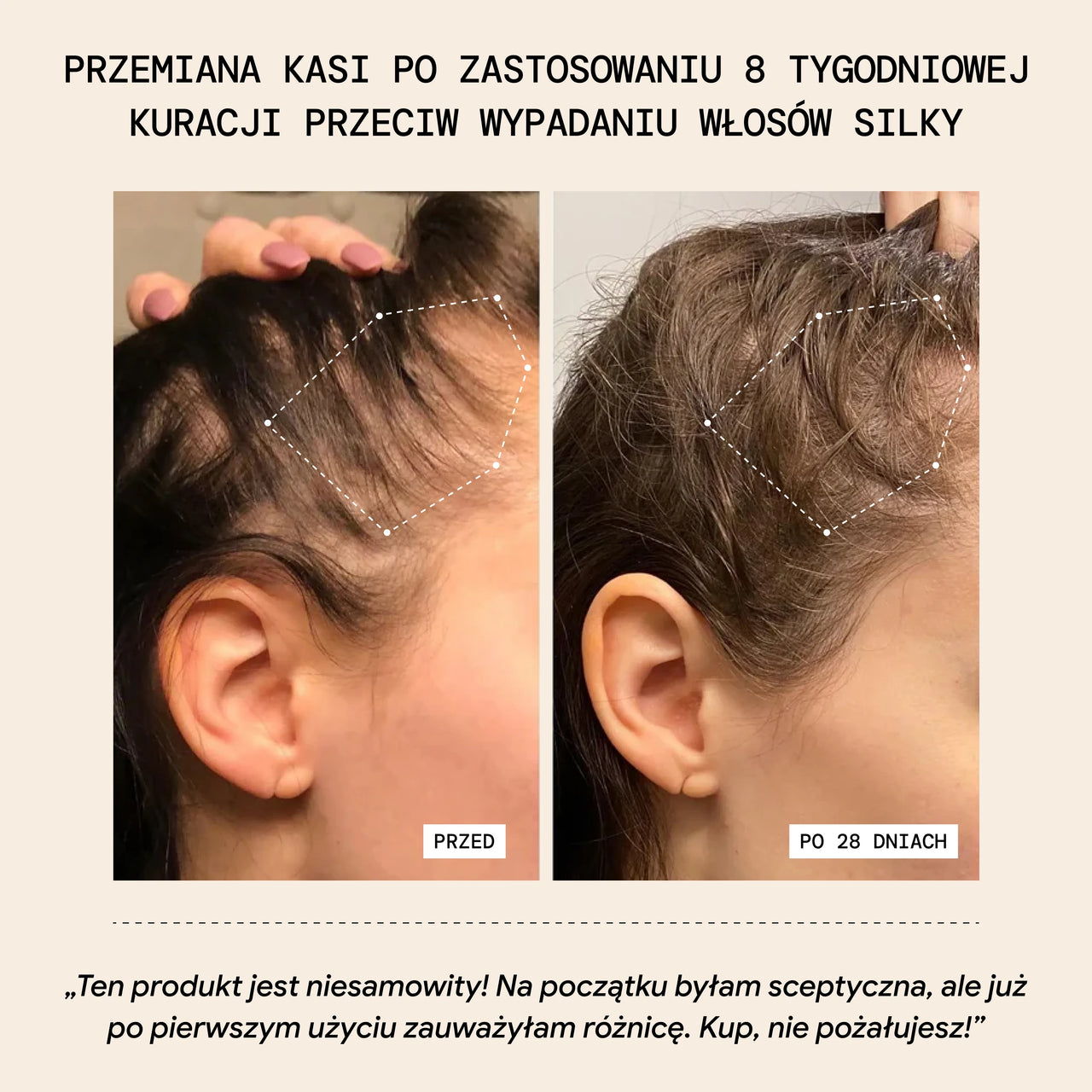 Zestaw Startowy Przeciw Wypadaniu
