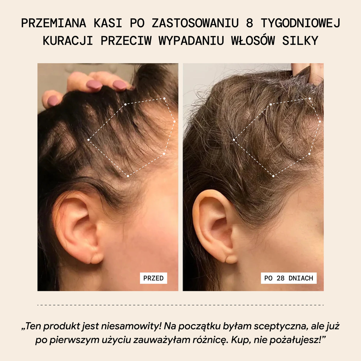 Szampon Przeciw Wypadaniu Włosów