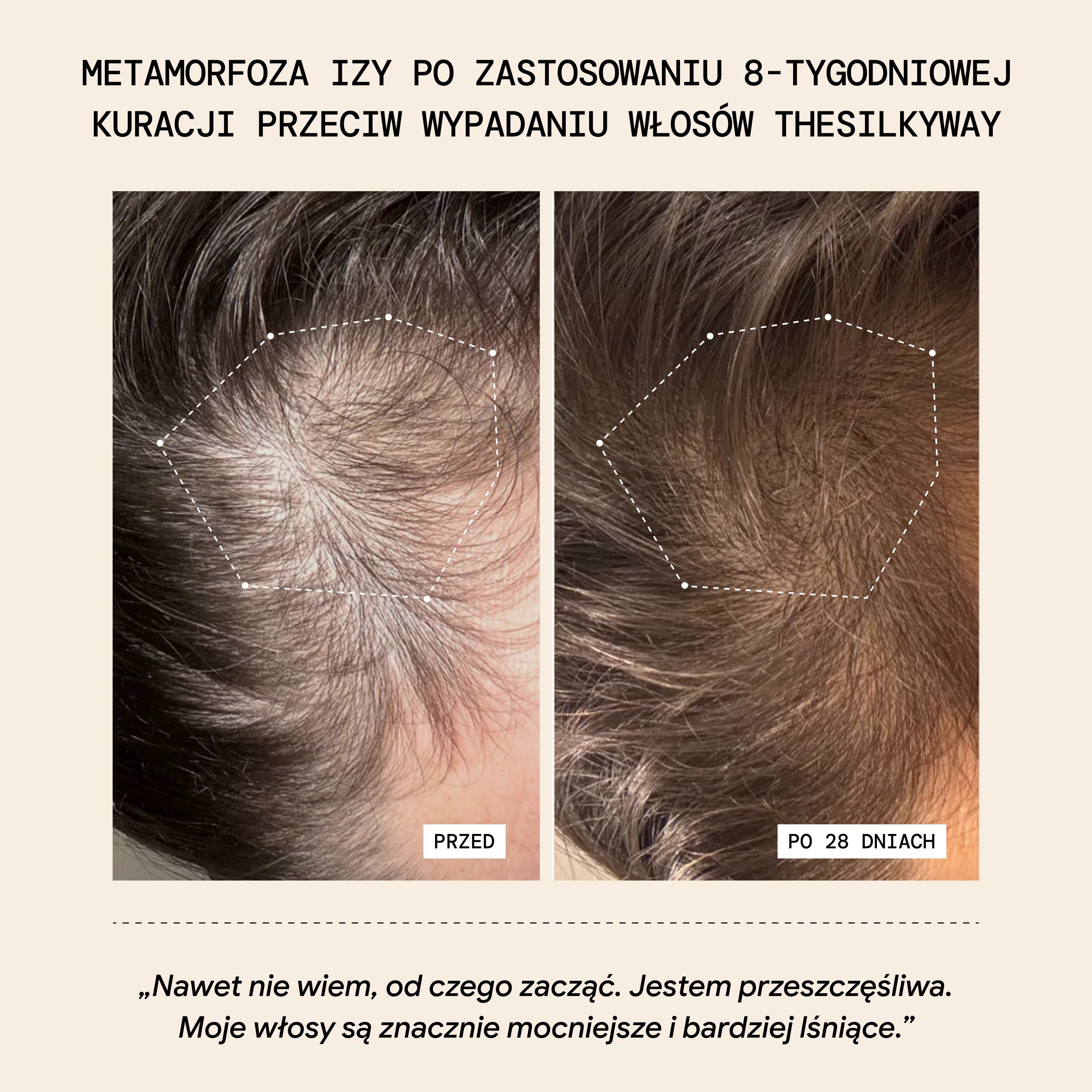 Maska Termo Przeciw Wypadaniu Włosów