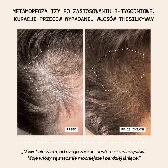 Maska Termo Przeciw Wypadaniu Włosów