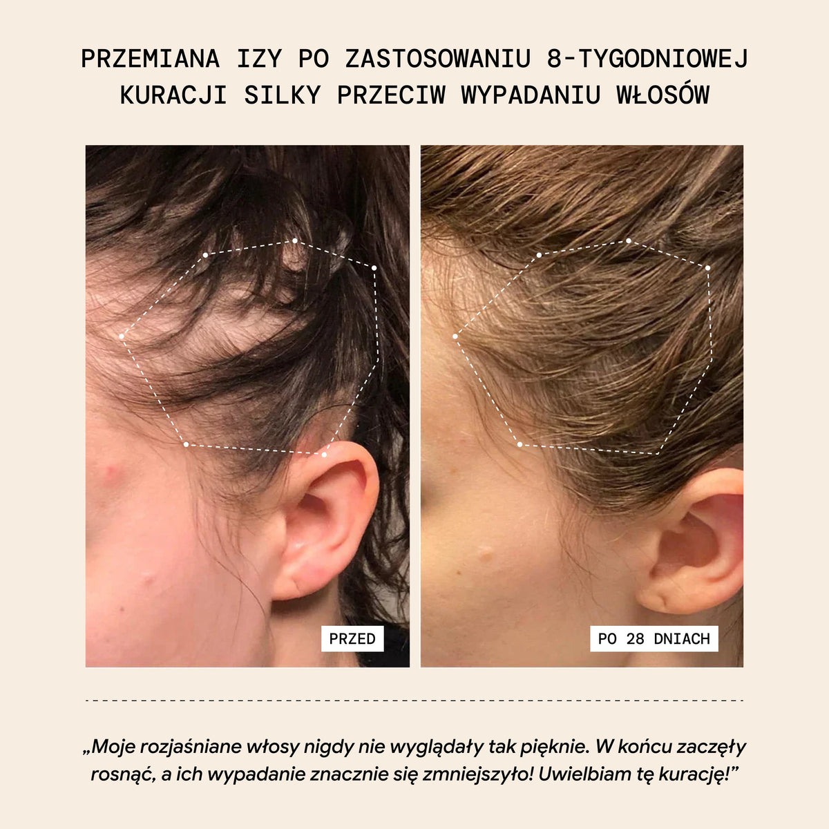 Serum redukujące wypadanie włosów