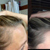8-tygodniowa Kuracja Redukująca Wypadanie Włosów